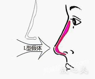 郑州市第二中医院哪些医生做鼻部整形最好?