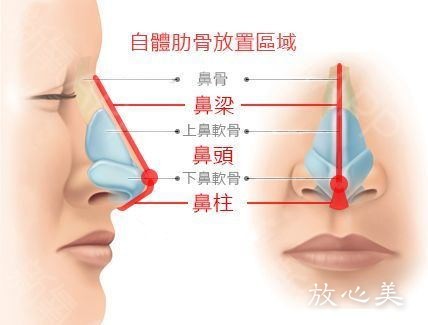 衡阳市第一人民医院医学整形中心做鼻综合需要多少钱 有副作用吗 